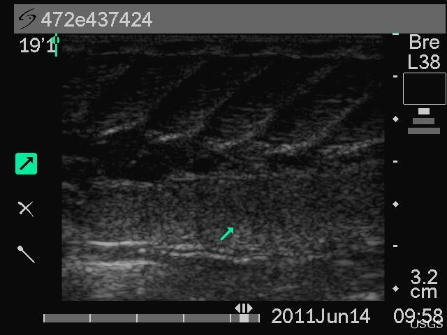 Image: Post Ultrasound