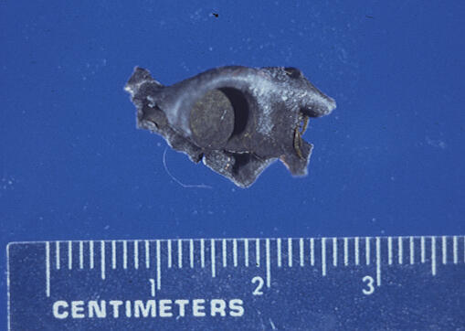 Image: Bullet Jacket Fragment