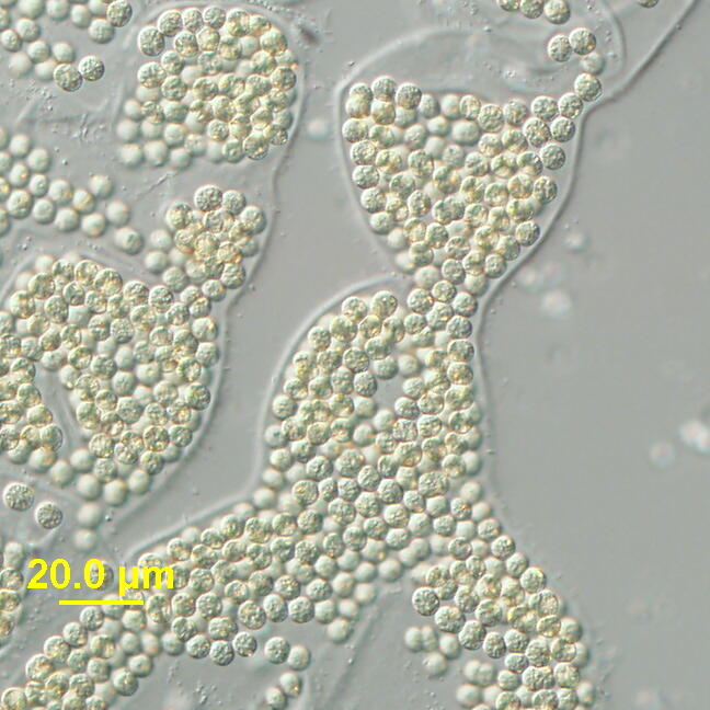 Image: Harmful Algal Blooms
