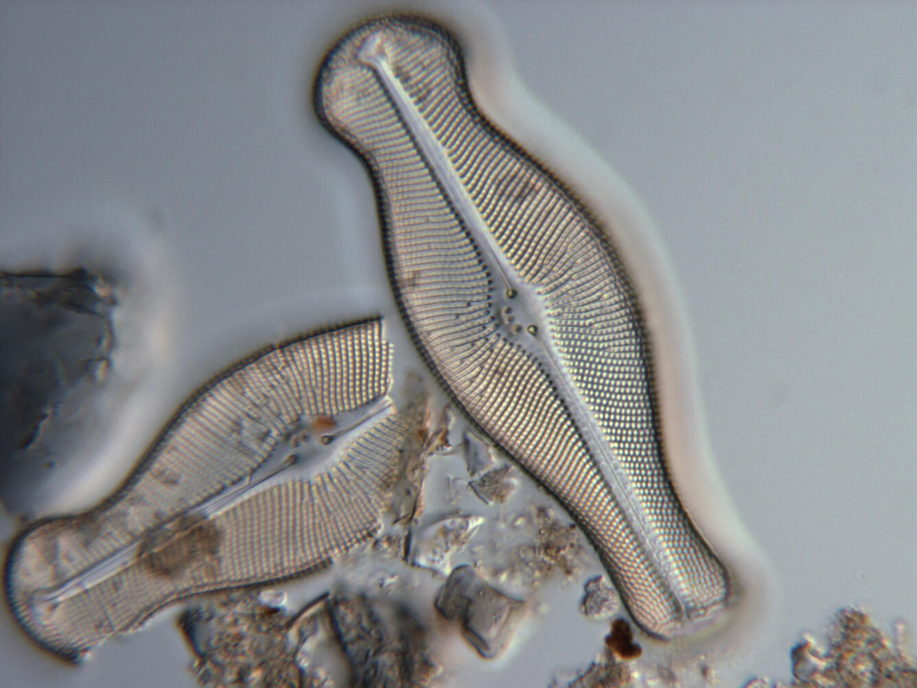 Image: Diatom 'Didymosphenia geminata' Cell Wall