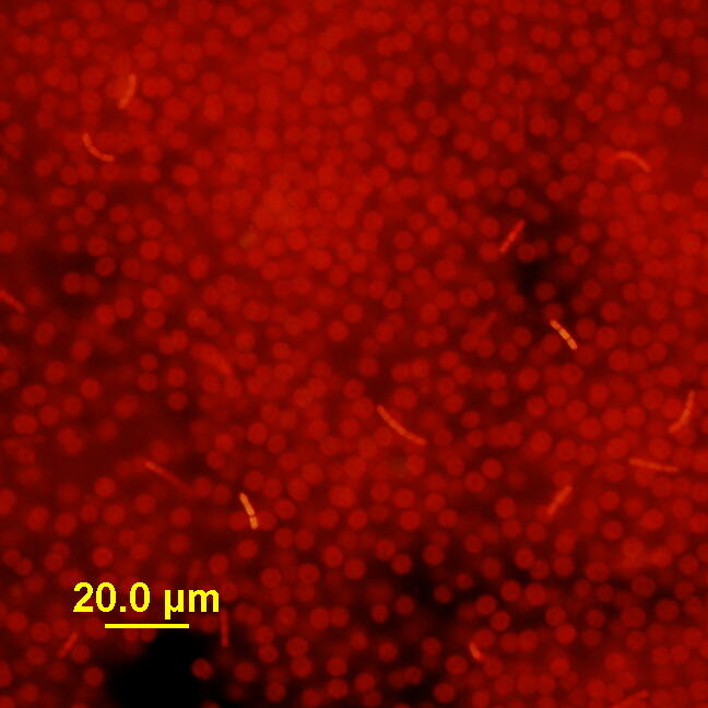 Image: Microcystis and Friends