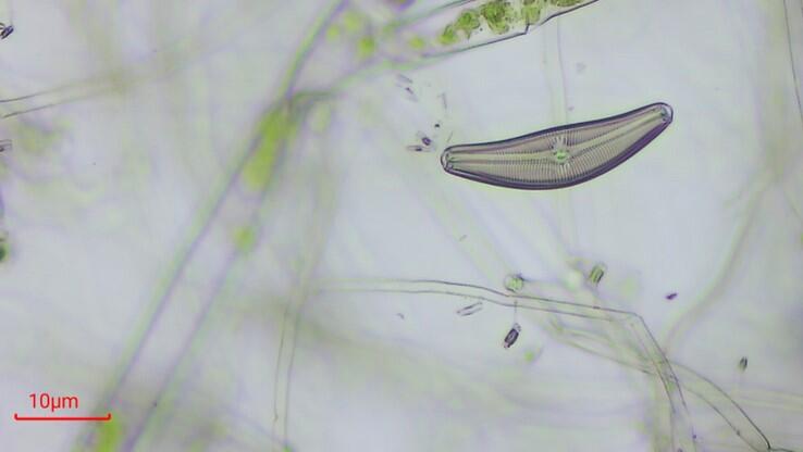 A diatom under a microscope with other strands of algae and a 10 micron indicator in the bottom left