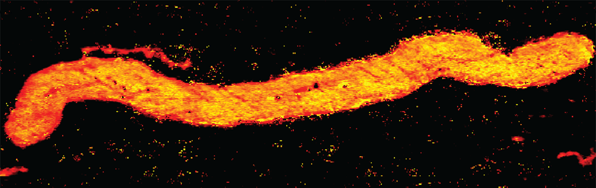 AGGER Project - Immature Tasmanites