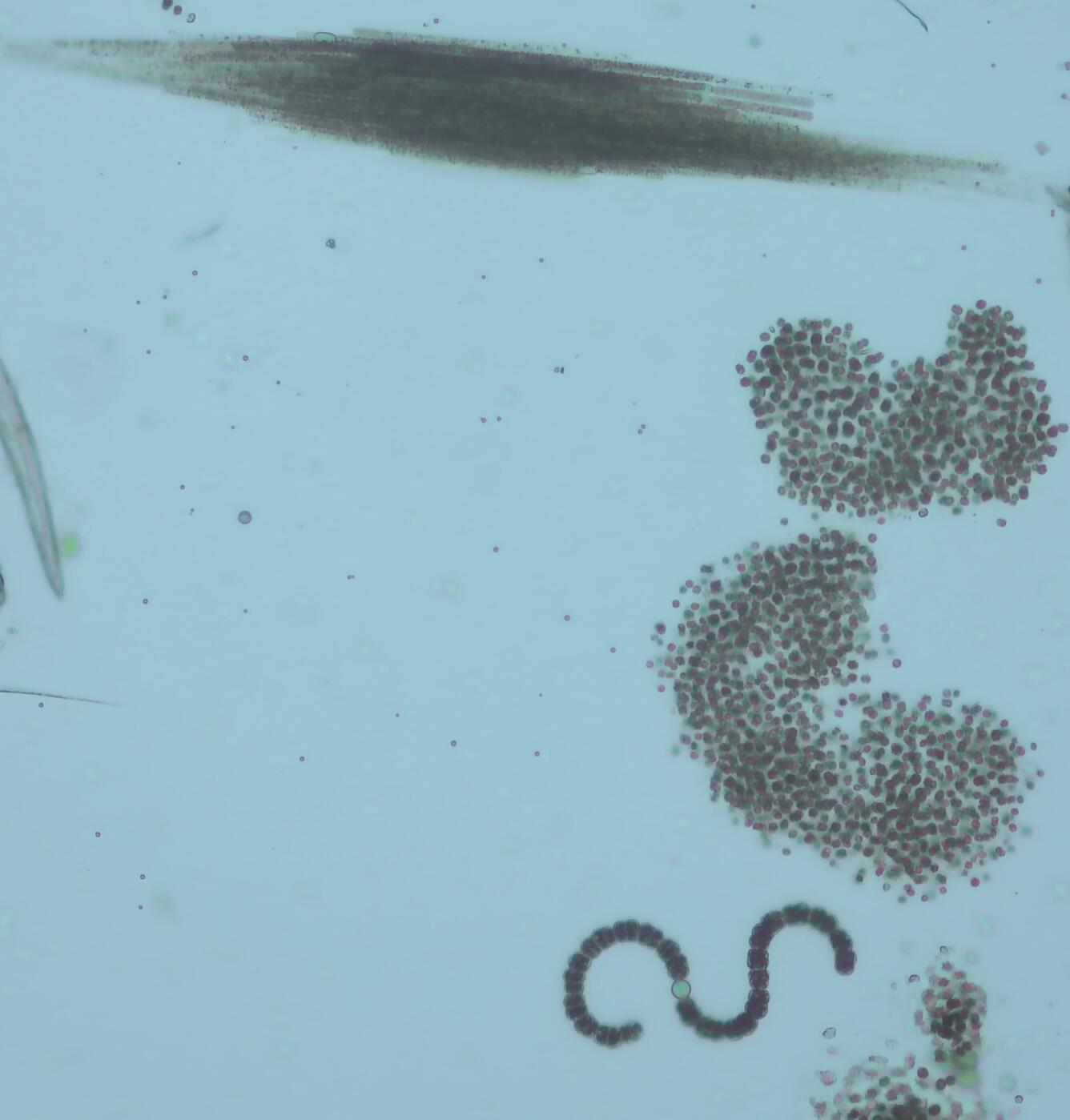 dark tinted microorganisms suspended in pale blue water