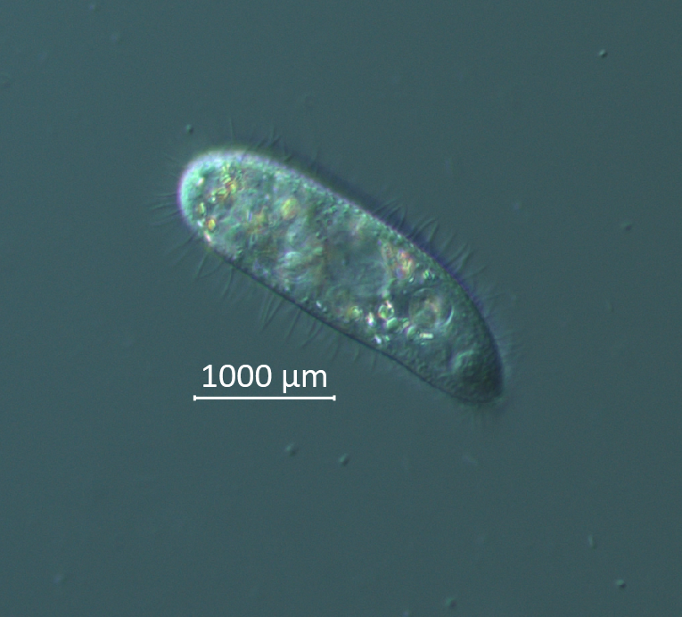 An oval-shaped microbe with small hairs, or cilia seen under a microscope