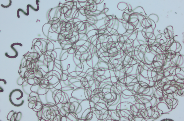 coiled microorganisms suspended in pale-blue water. One is thick coils and the the other is fine and looks like spaghetti