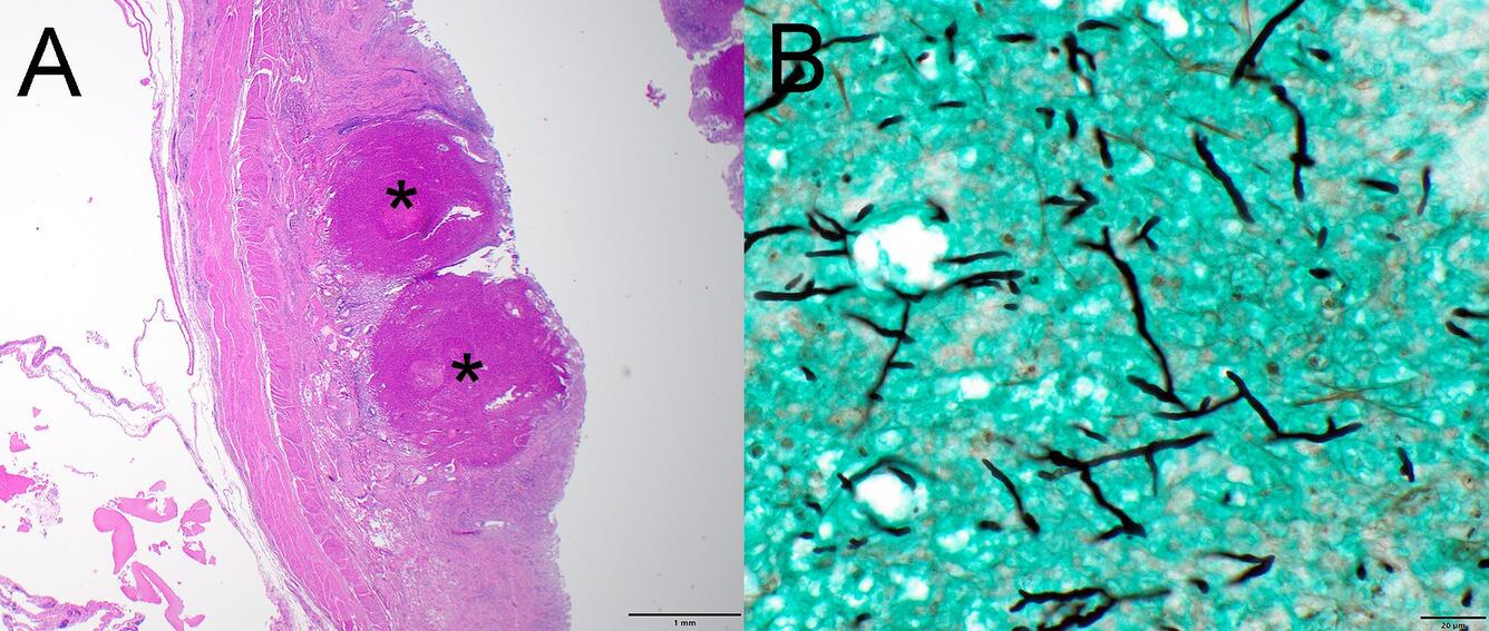 Photomicrographs from a Canada Goose (Branta canadensis) found dead in Wisconsin, USA. (B)