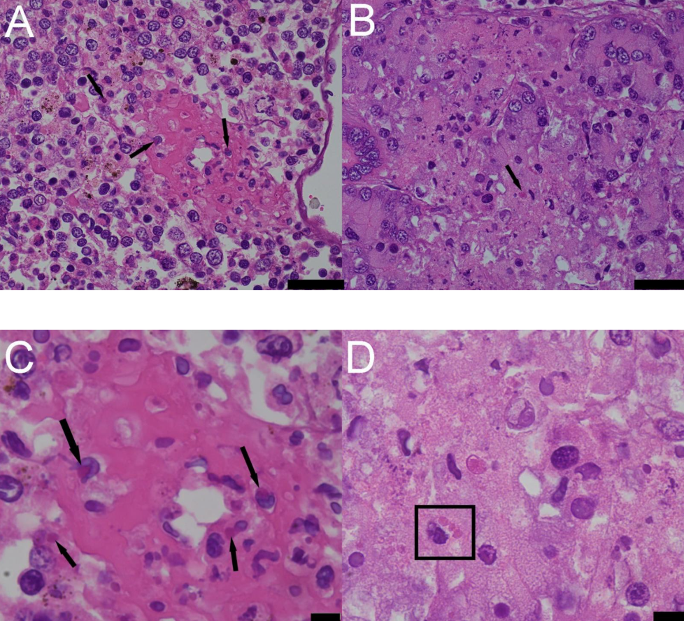 fibrinoid vascular necrosis_Photomicrographs from a Barred Tiger Salamander (Ambystoma mavortium) found dead in Idaho, USA.