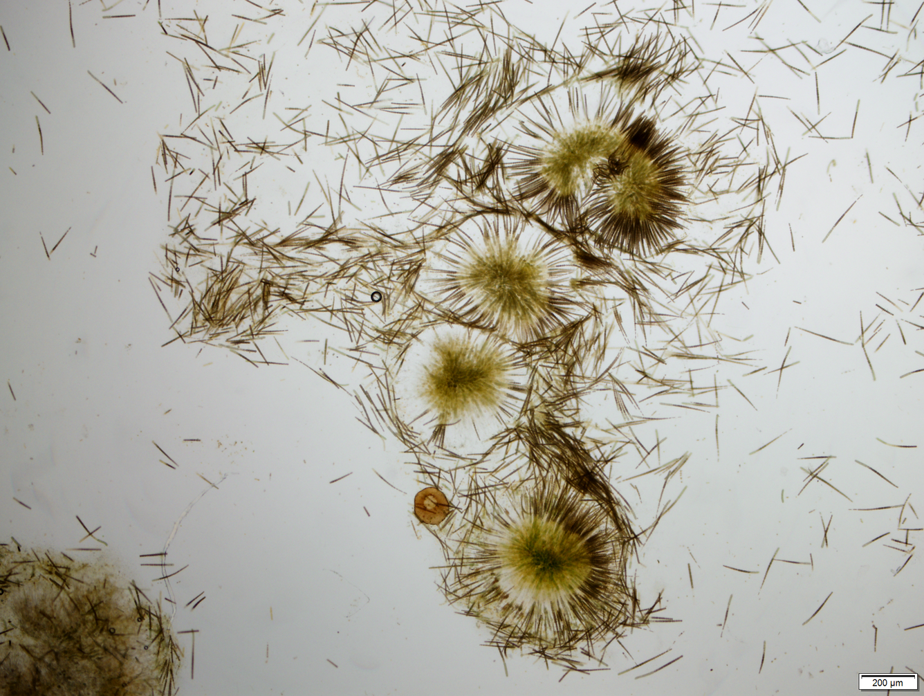 Gloeotrichia, a type of cyanobacteria that can produce microcystin, in a water sample collected from Kabetogama Lake