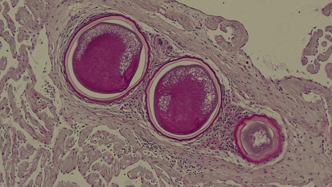 stained histology slide of heart tissue with 3 parasitic schizonts visualized as 3 encysted ovals in surrounding tissue.
