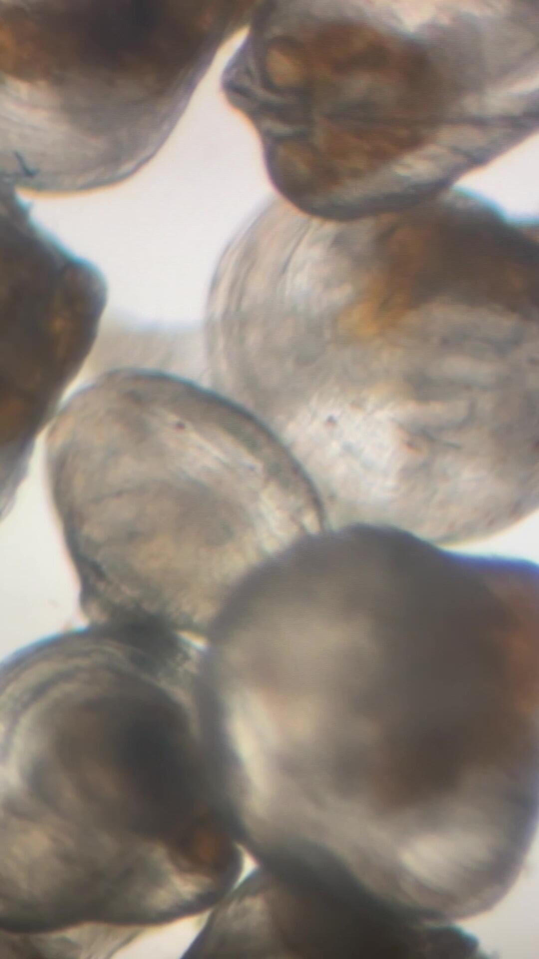 Translucent juvenile muscles under a microscope, showing their organs