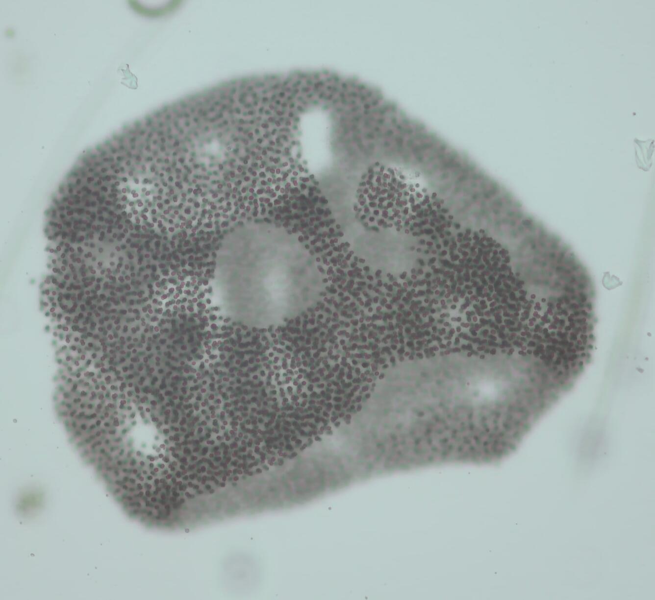dark-grey gumdrop shaped blob composed of tiny dots. Structure has holes like Swiss cheese. Suspended in pale blue water.