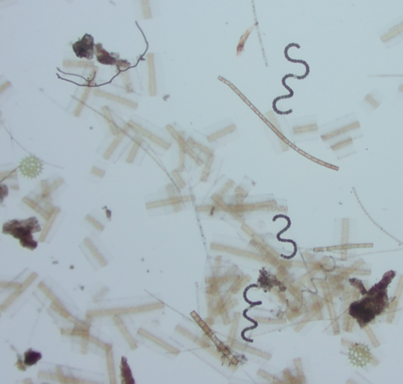 tan and darker brown organisms suspended in pale blue water