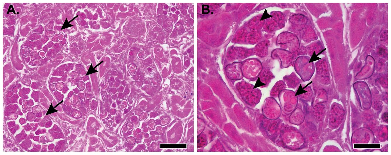 Snow geese with renal coccidiosis. Histology_Kidney