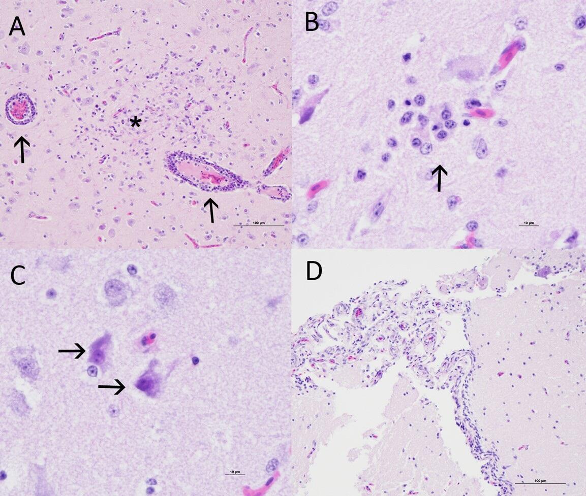 Photomicrographs from a double-crested cormorant (Nannopterum auritum) from Minnesota, USA.