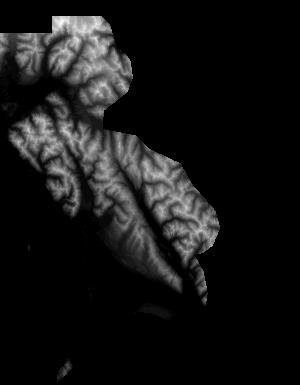 Digital Surface Model DSM
