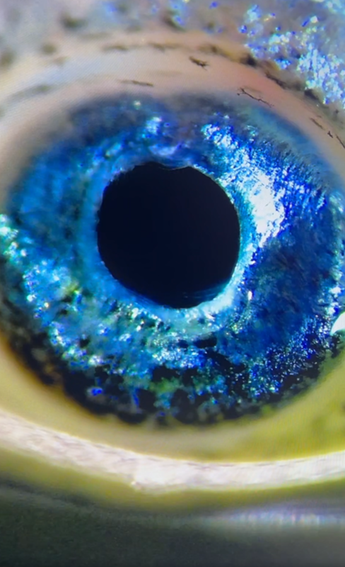 sucker eye with eye fluke parasite in middle
