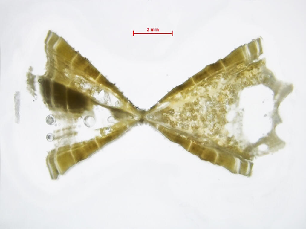 Fish Vertebra Cross Section