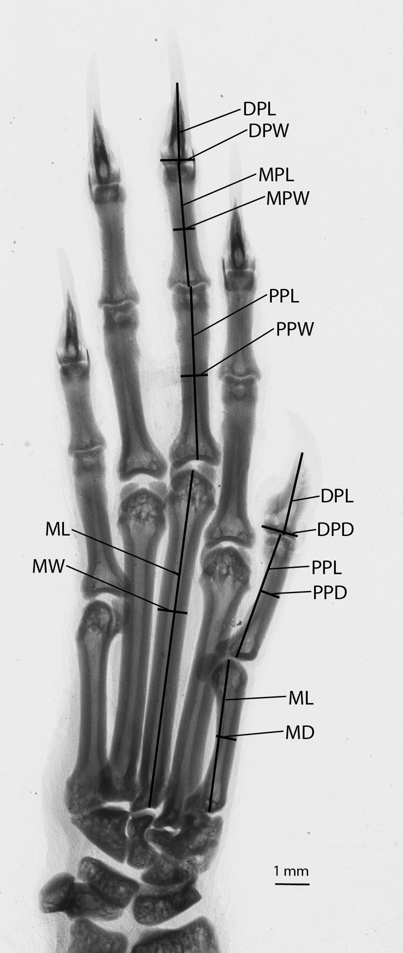 Digital X-ray of the right manus