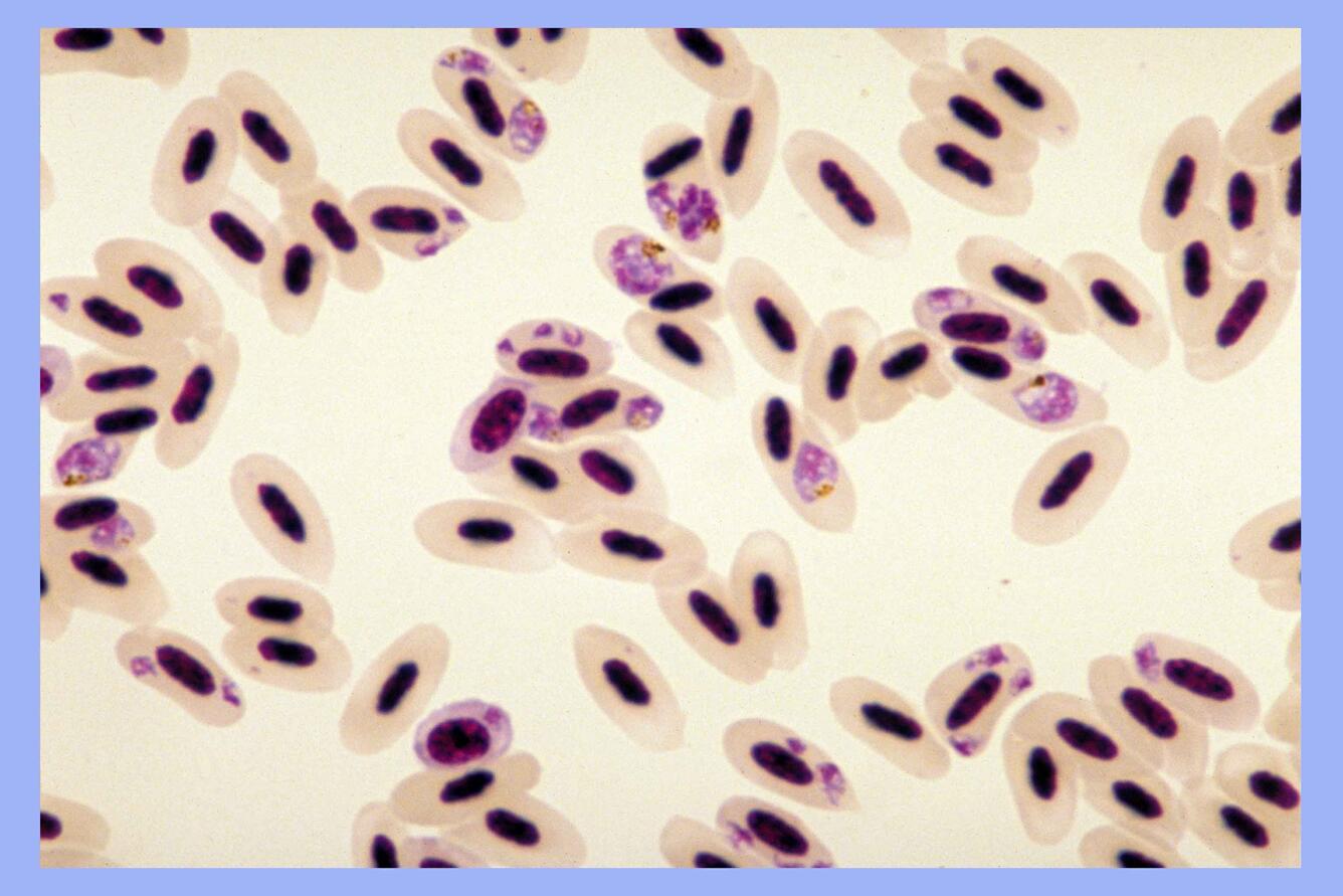 Plasmodium relictum