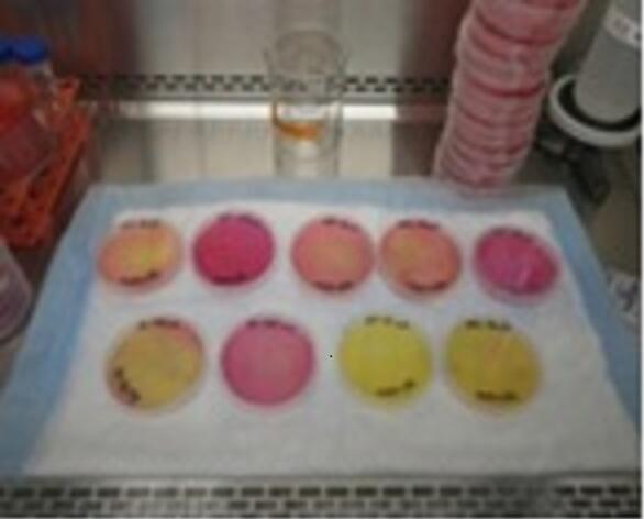 Multiple Petri dishes with various water samples monitoring showing color differences for antibiotic resistance.