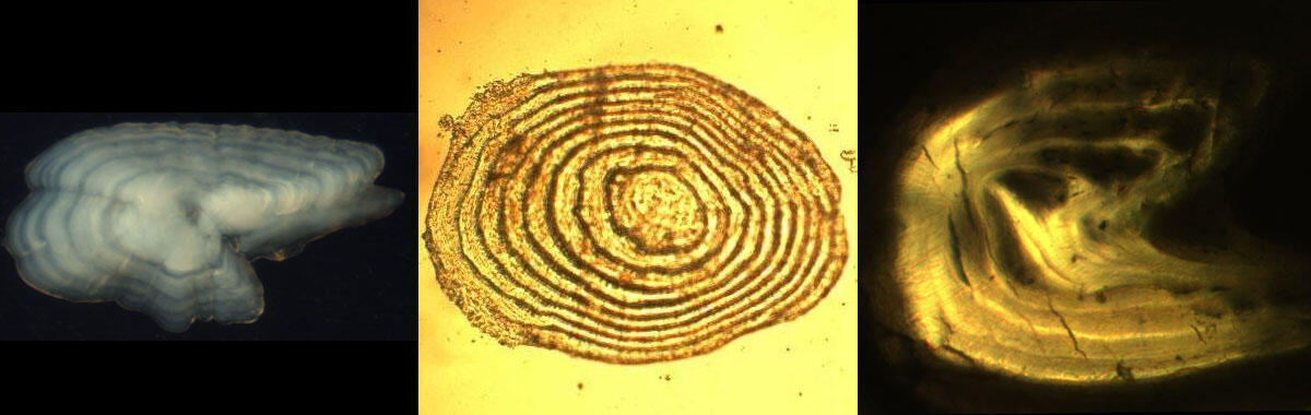 Fish structures (otolith, scale, fin ray)