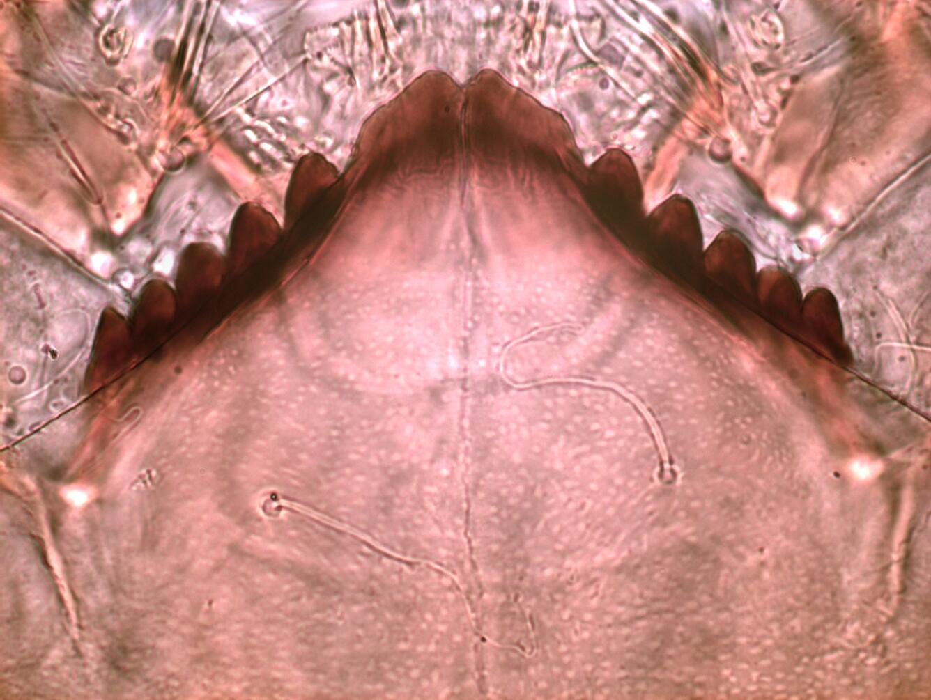 Psectrocladius Mentum image
