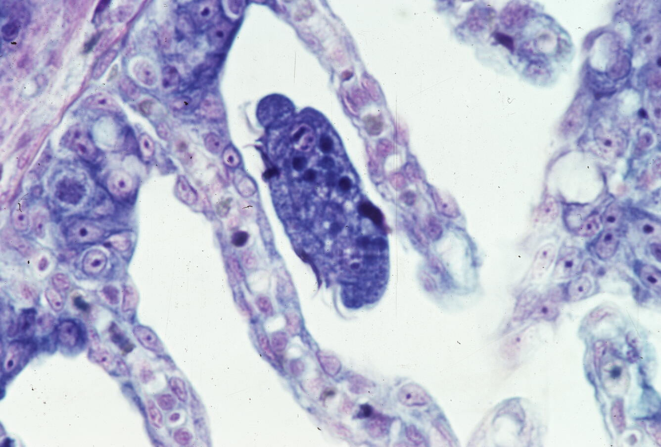 Trichodina sp.