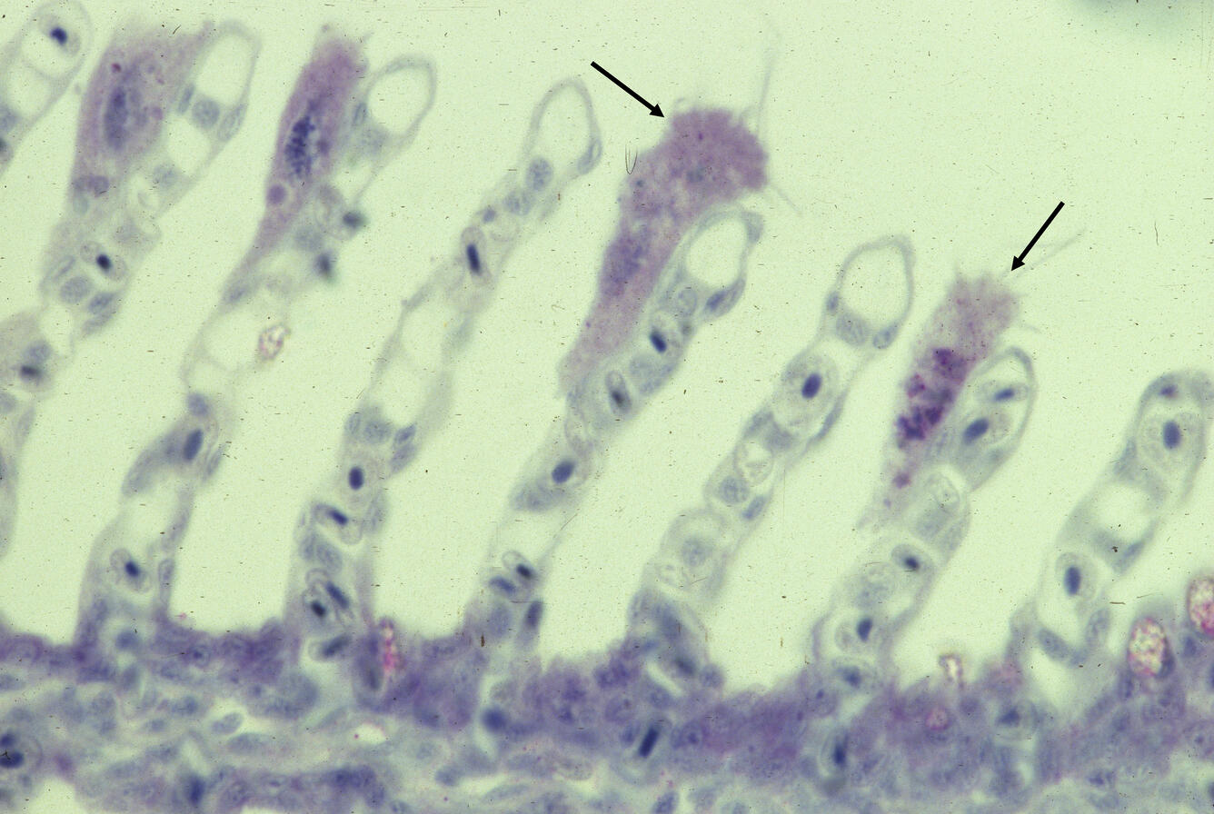 Trichophrya sp.