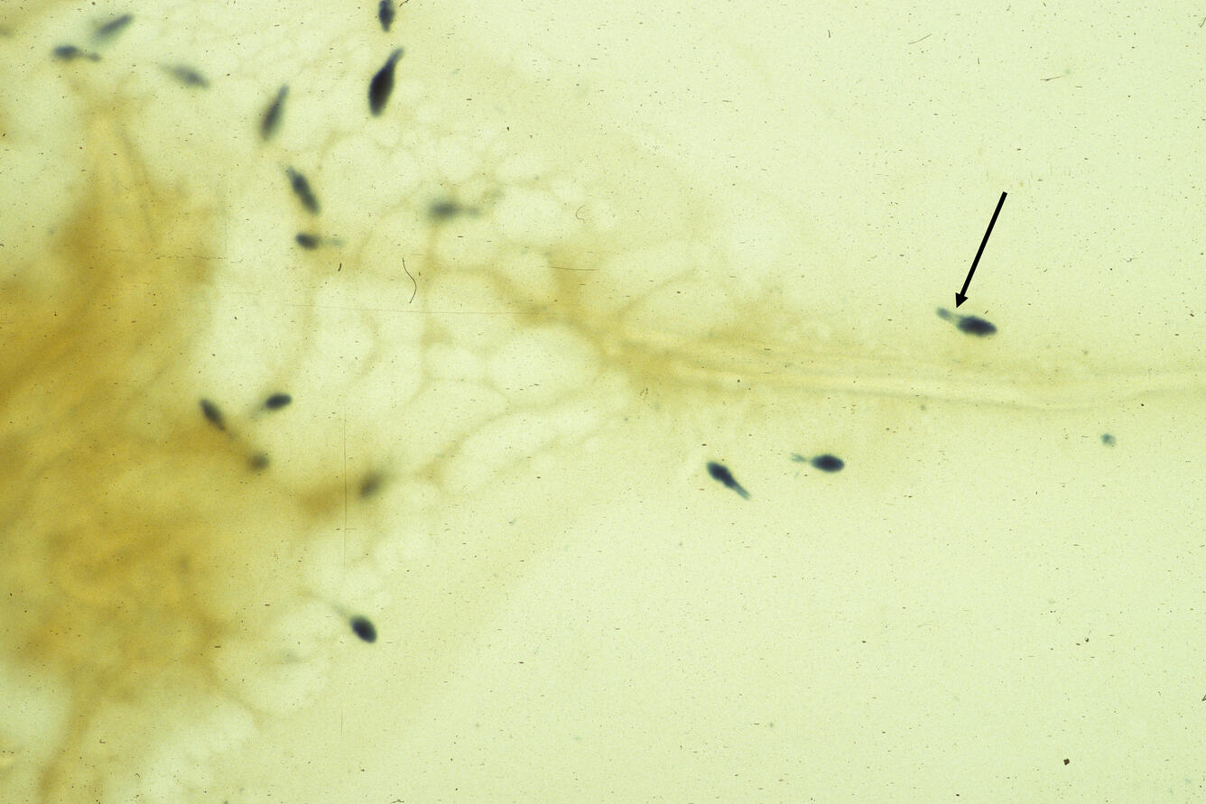 Spironucleus (Hexamita) salmonis