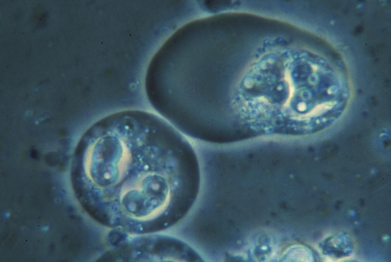 C. shasta
