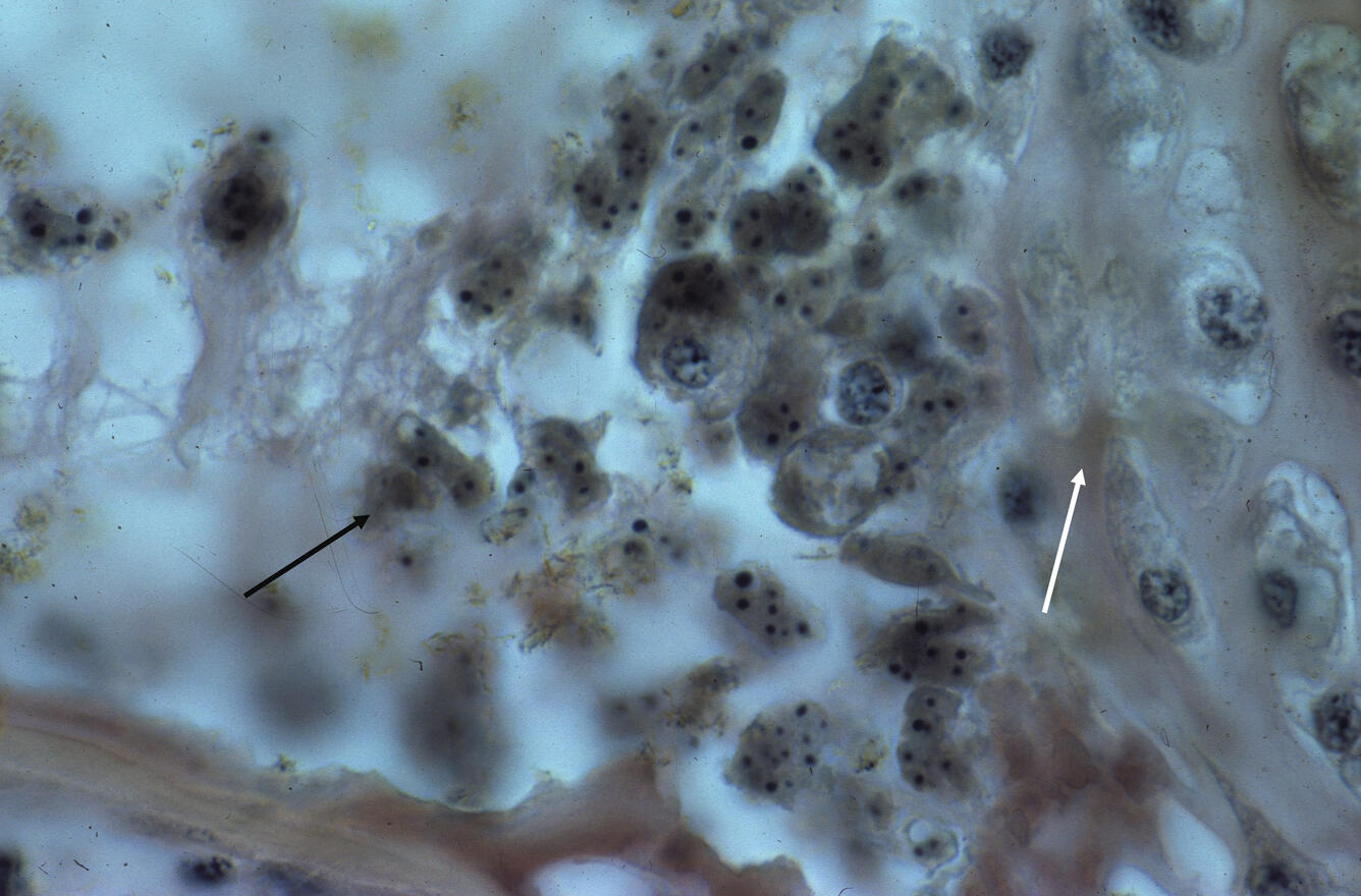 M. cerebralis
