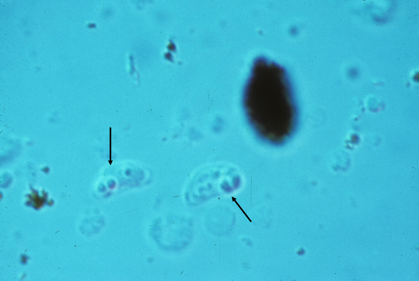 Parvicapsula sp.