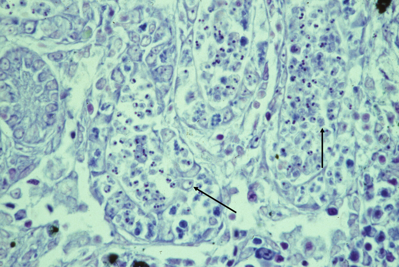 Parvicapsula sp.
