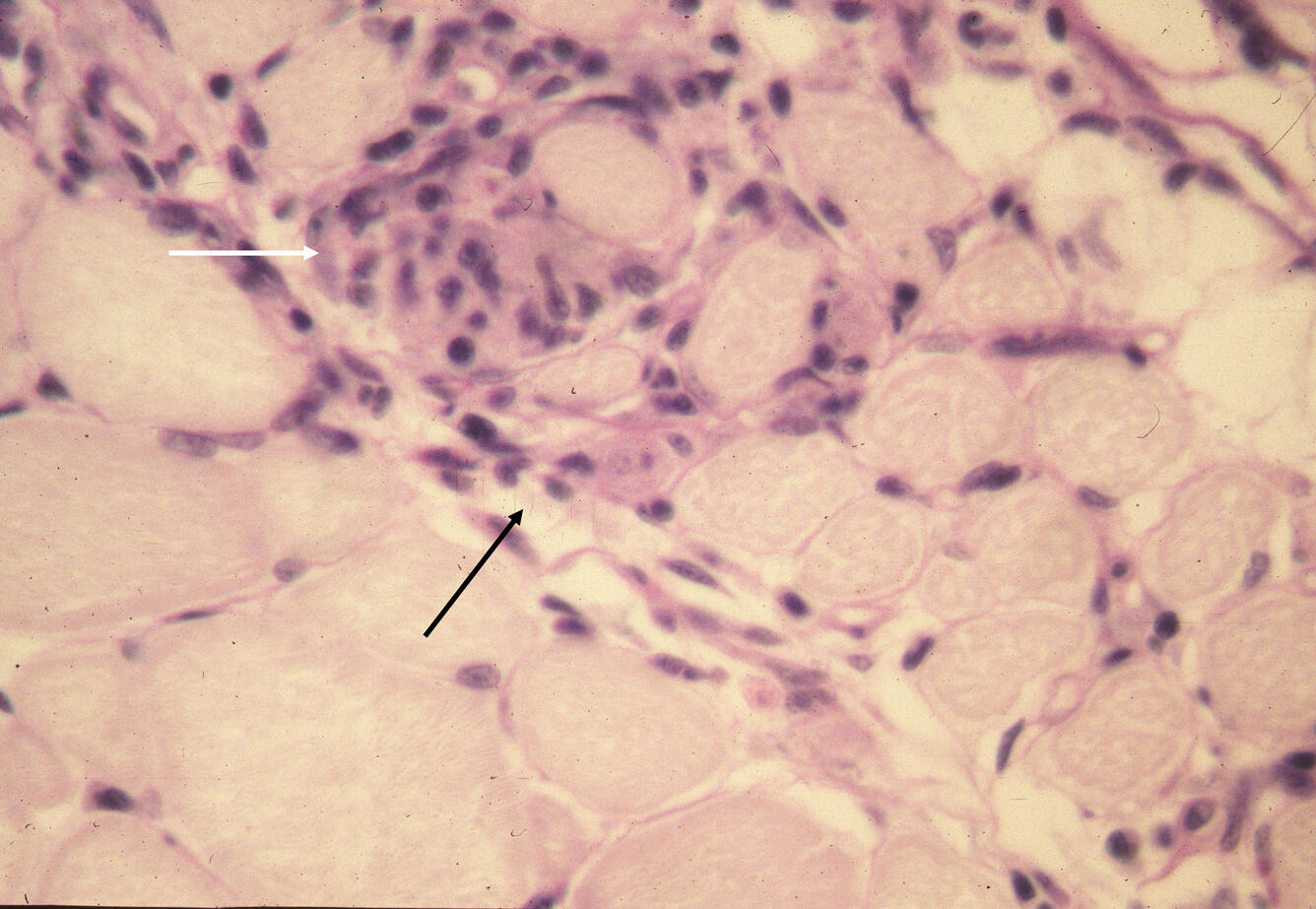 T. bryosalmonae