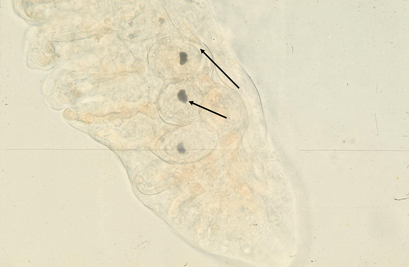 Sanguinicola sp.