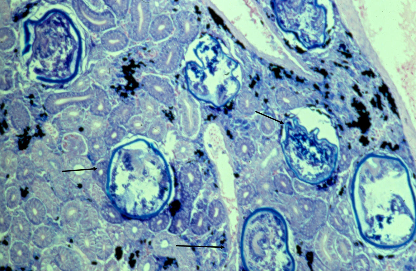 Nanophyetus salmincola