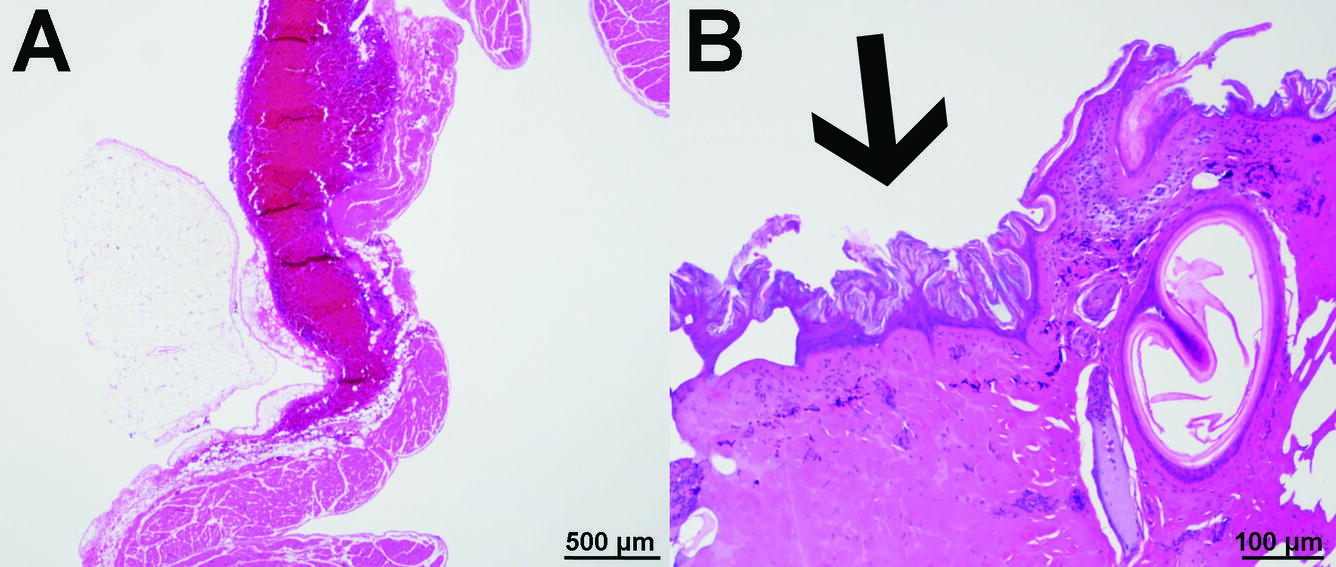 Photo showing close ups of hemorrhage and necrosis in pink in purple colors.