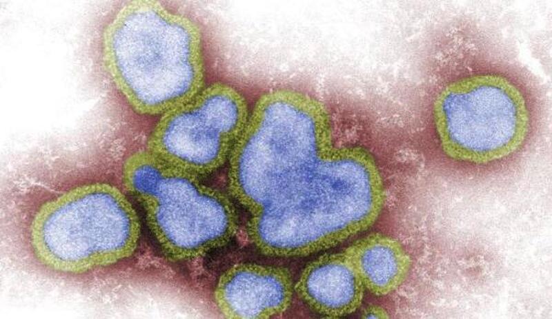 Avian influenza viruses. Digitallycolorized negative-stained transmission electron micrograph (TEM).