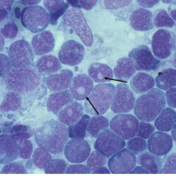 Nucleospora (Enterocytozoon) salmonis