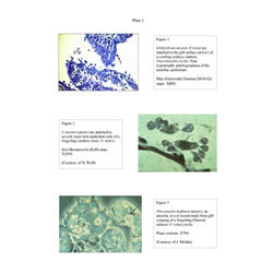 Histopathology - Plate 1 - Figures 1-3 thumb