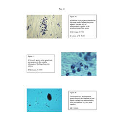 Histopathology - Plate 12 - Figures 34-36 thumb