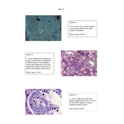 Histopathology - Plate 16 - Figures 46-48 thumb