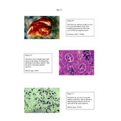 Histopathology - Plate 17 - Figures 49-51 thumb