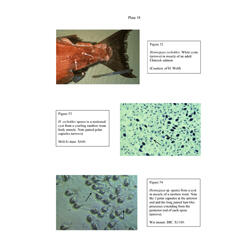 Histopathology - Plate 18 - Figures 52-54 thumb