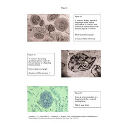 Histopathology - Plate 21 - Figures 61-63 thumb