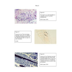 Histopathology - Plate 22 - Figures 64-66 thumb