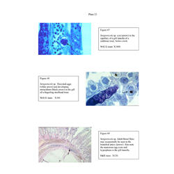 Histopathology - Plate 23 - Figures 67-69 thumb