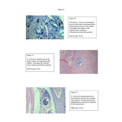 Histopathology - Plate 24 - Figures 70-72 thumb
