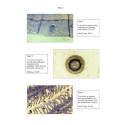 Histopathology - Plate 3 - Figures 7-9 thumb